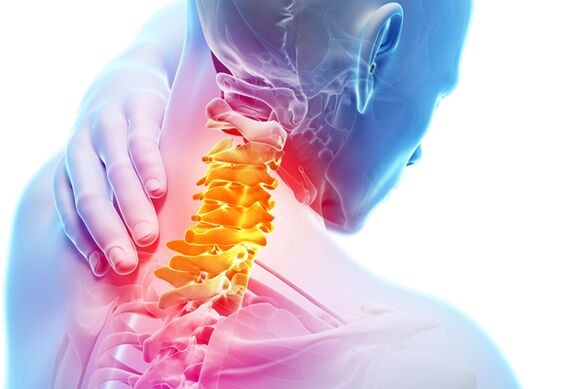 Шейный остеохондроз
